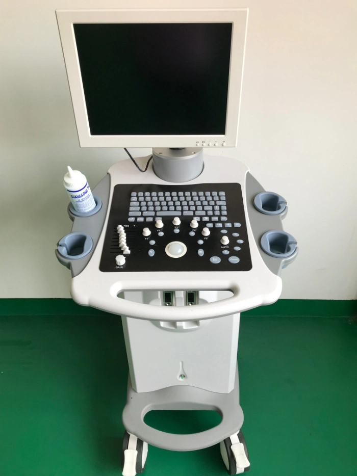 15" LED 3D Ob Gyn Obstetrics Trolley Ultrasound Machine 3D Trolley Ultrasound Device